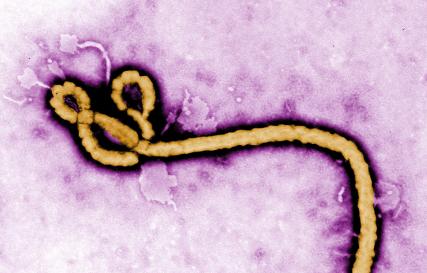 Откуда взялся вирус Эбола?